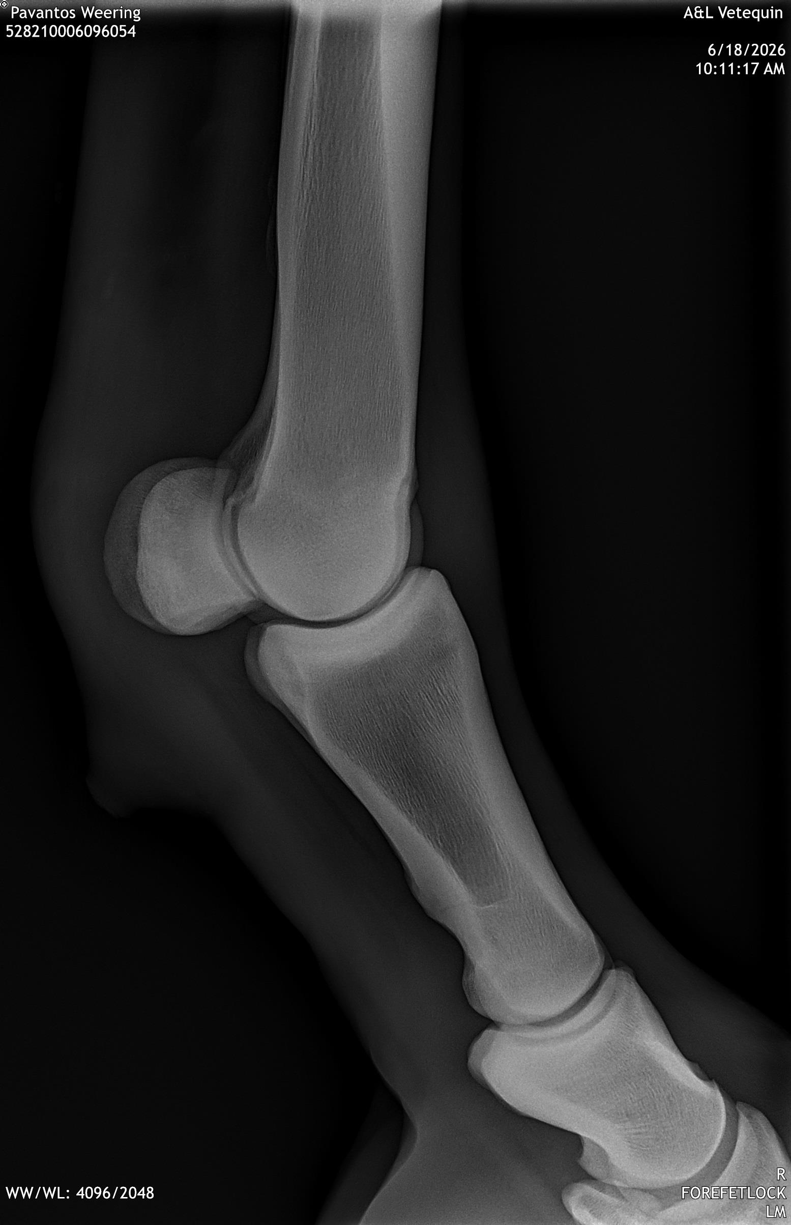 radio