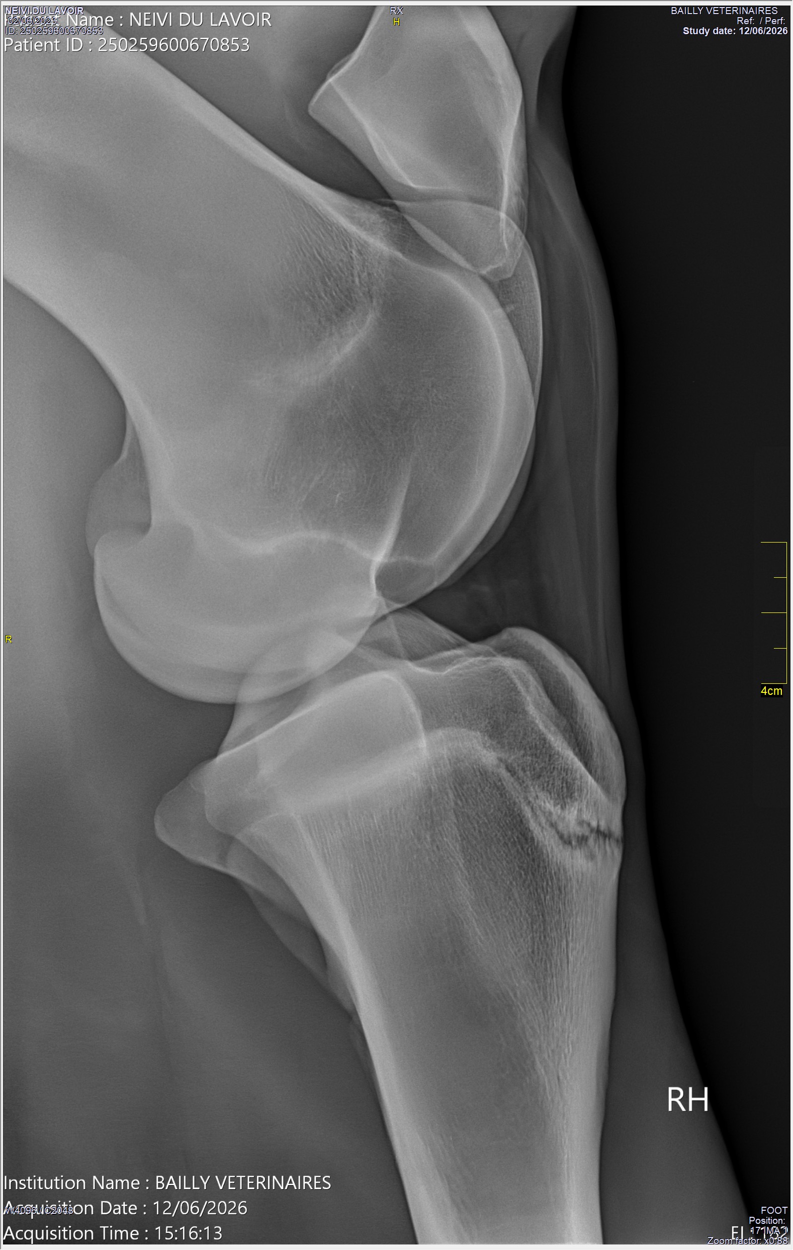 radio