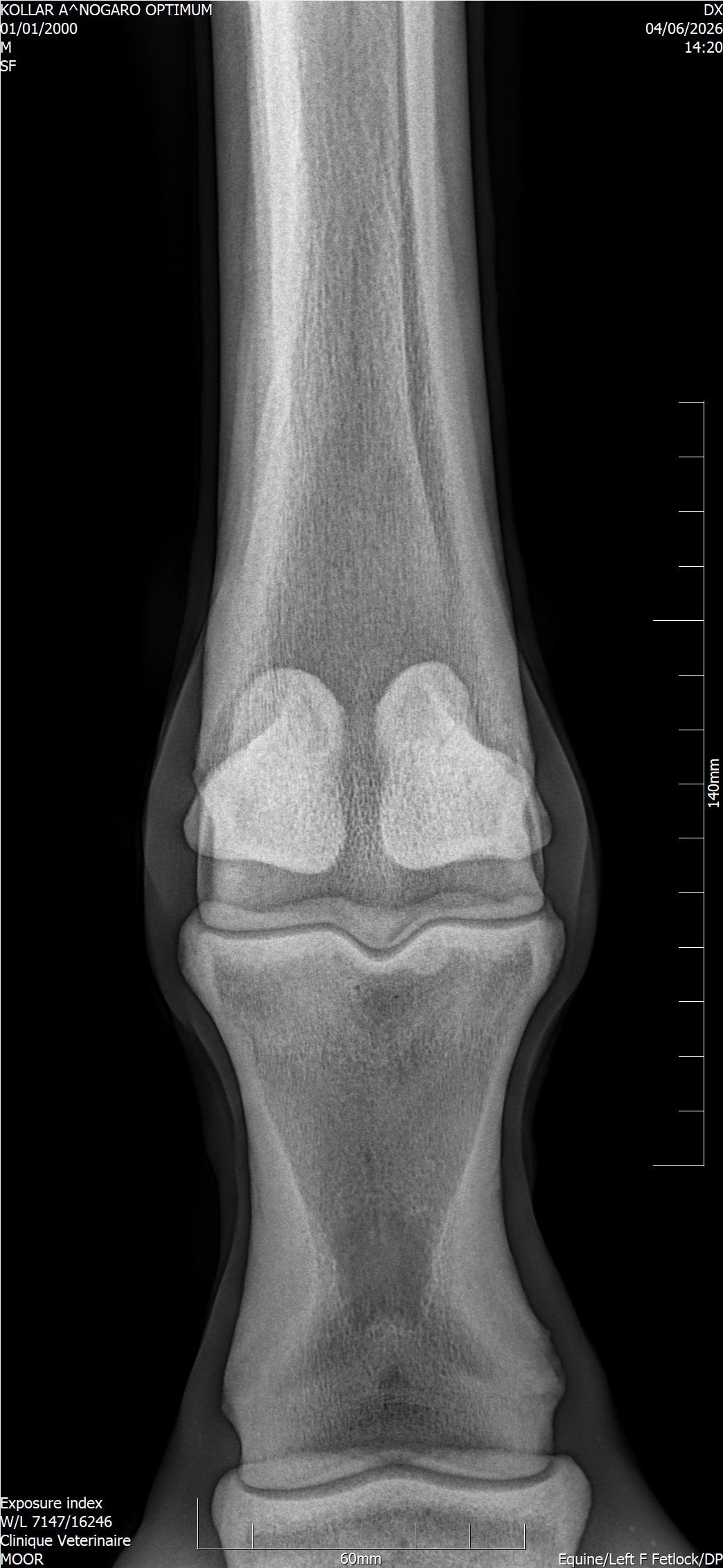 radio