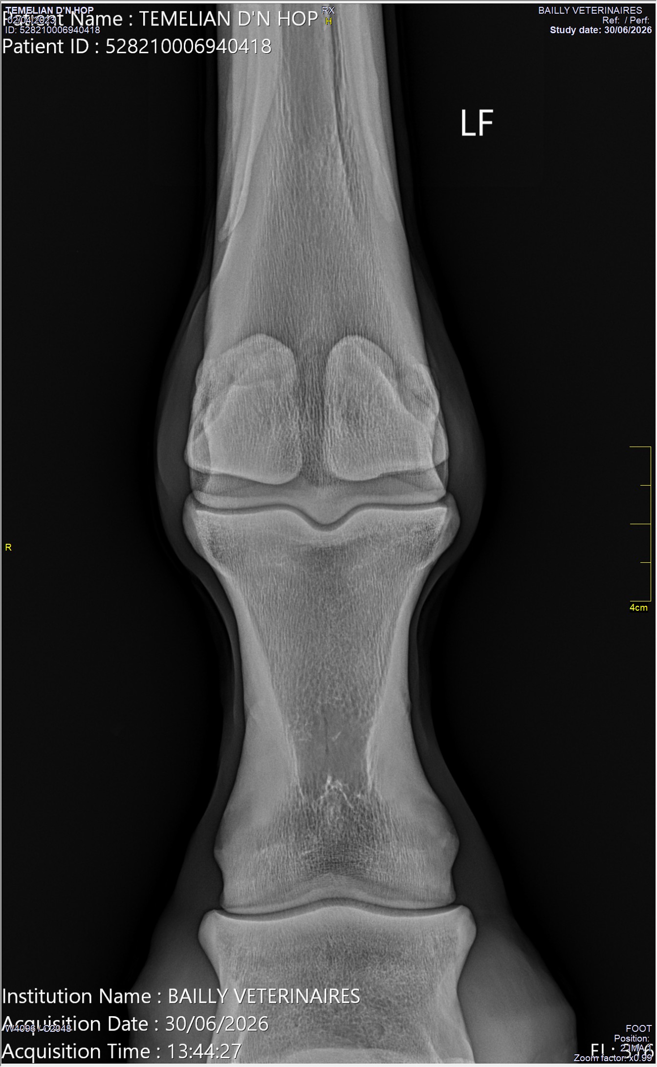 radio