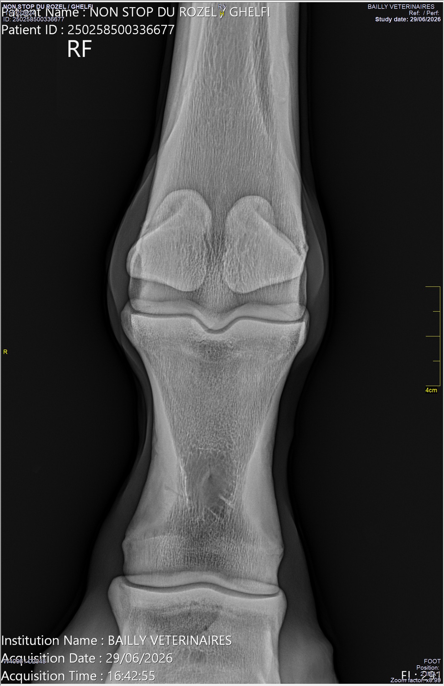 radio