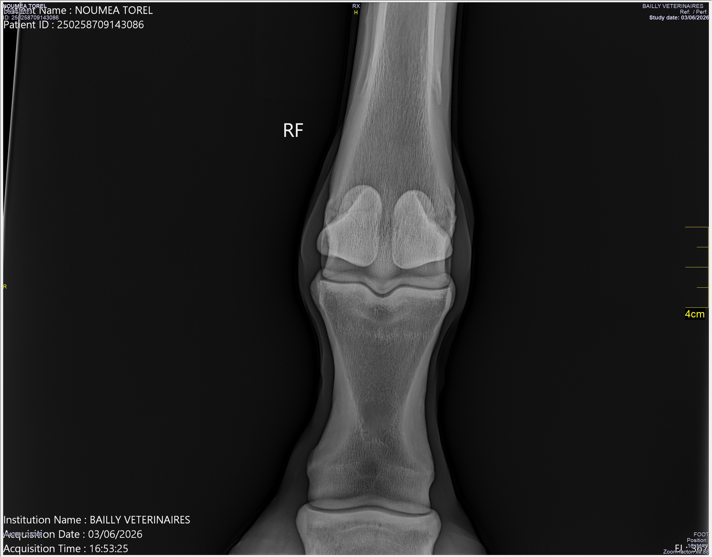 radio