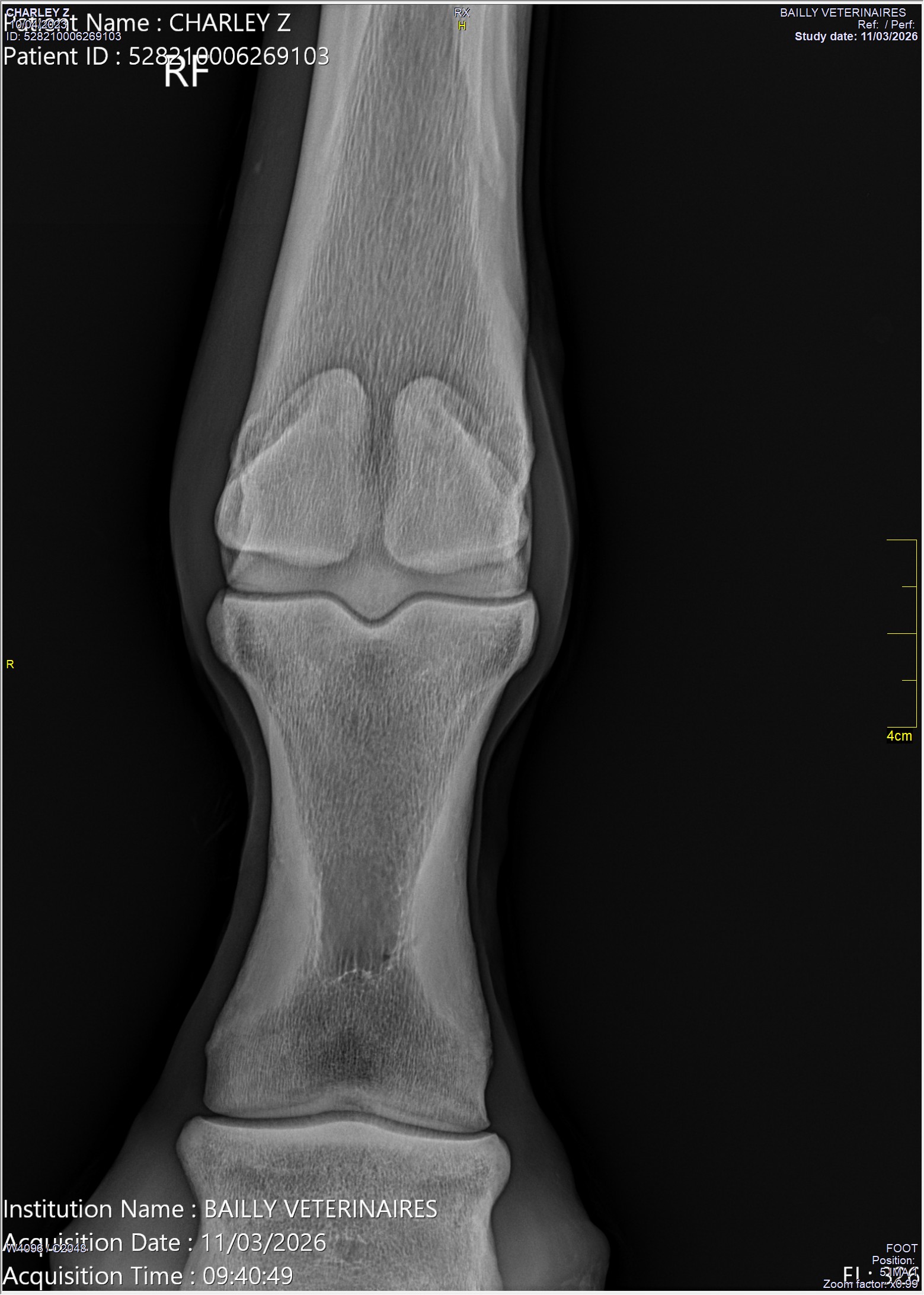 radio