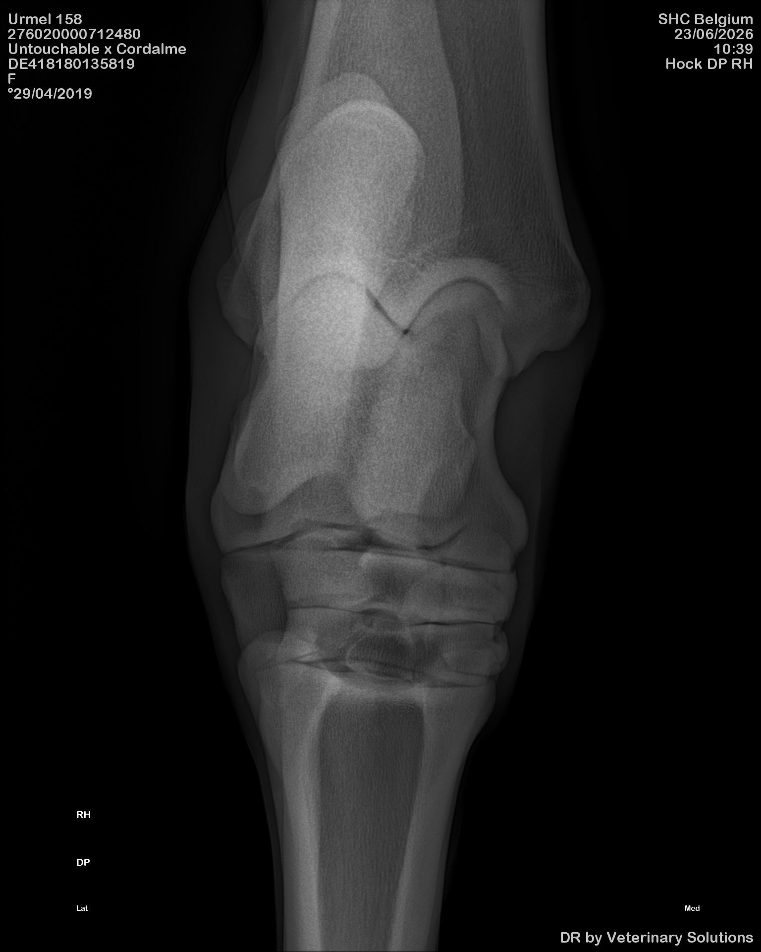 radio