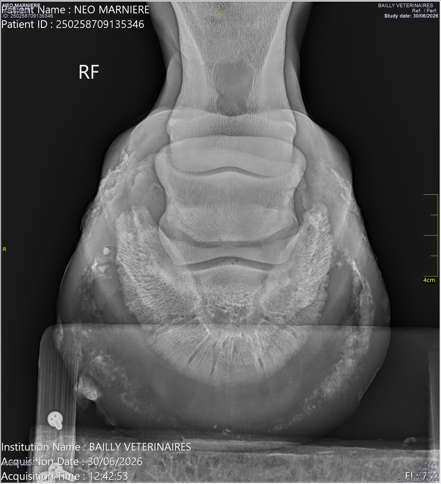 radio