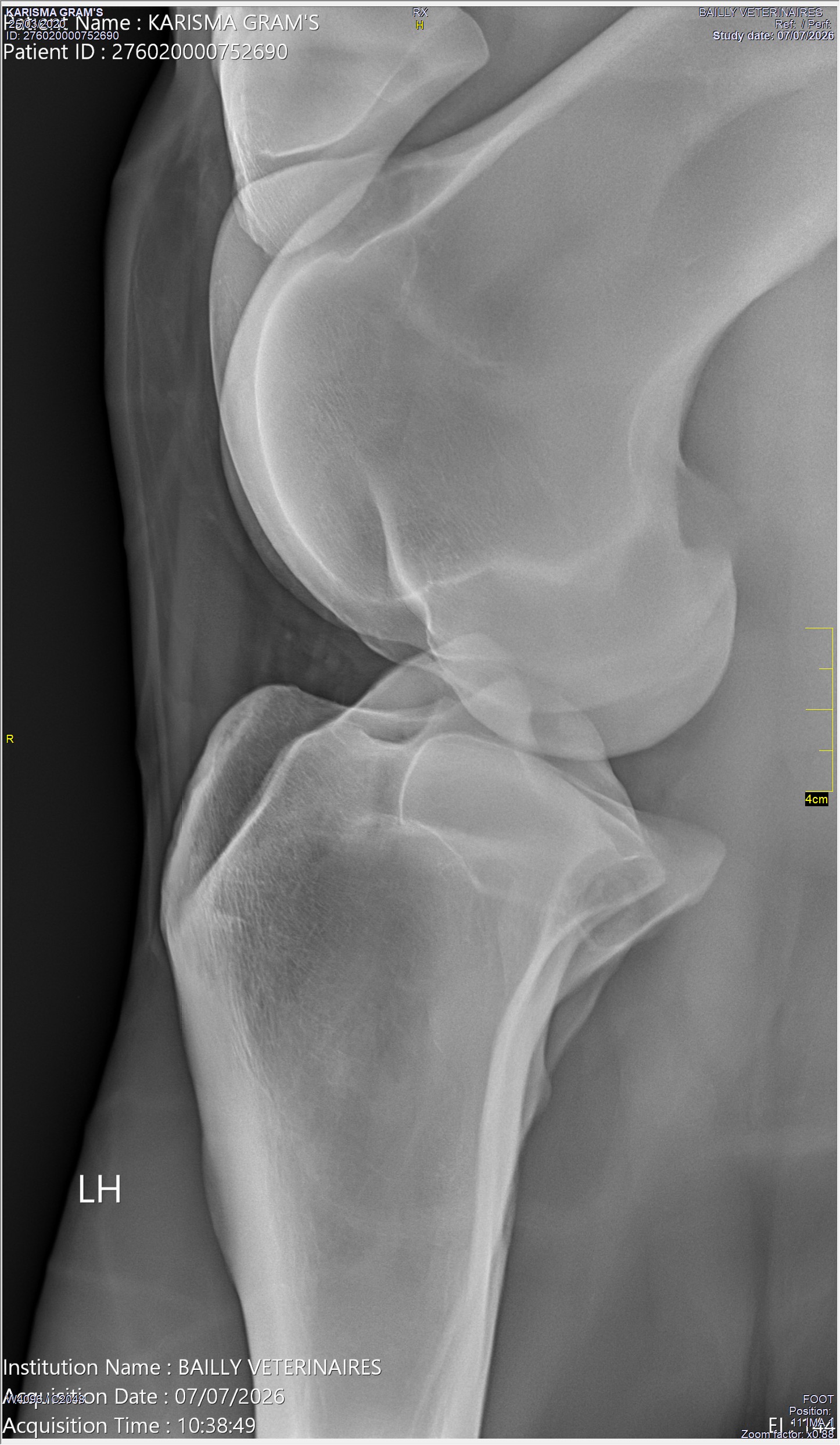 radio